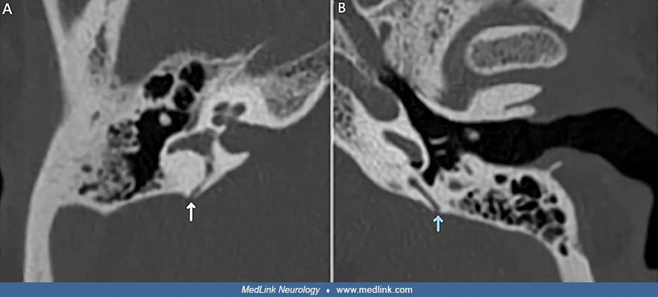 Sscddl 25 6